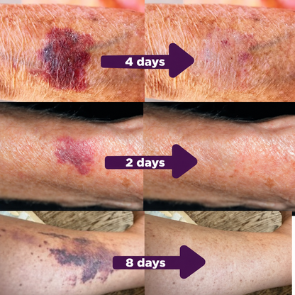 BruiseGuard™ Fade & Repair Serum