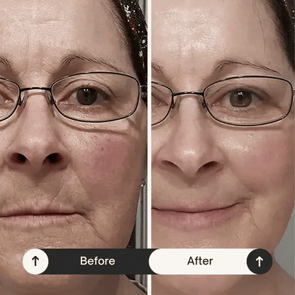 Firmagen™ Collagen Peptide Ampoule + Niacinamide